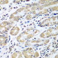 Immunohistochemistry of paraffin-embedded Human stomach using EIF1AX Polyclonal Antibody at dilution of 1:100 (40x lens) .