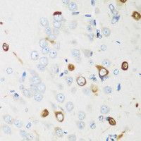 Immunohistochemistry of paraffin-embedded Rat brain using ELAVL2 Polyclonal Antibody at dilution of 1:200 (40x lens) .