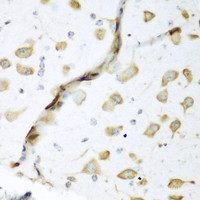 Immunohistochemistry of paraffin-embedded Mouse brain using ELAVL2 Polyclonal Antibody at dilution of 1:200 (40x lens) .