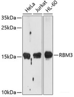 Western blot analysis of extracts of various cell lines using RBM3 Polyclonal Antibody at dilution of 1:1000.