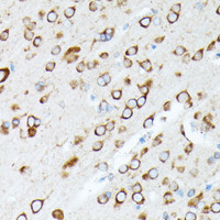 Immunohistochemistry of paraffin-embedded Rat brain using RPL7 Polyclonal Antibody at dilution of 1:100 (40x lens) .