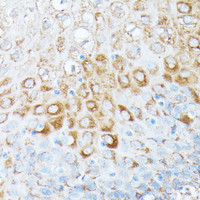 Immunohistochemistry of paraffin-embedded Human esophageal using RPL7 Polyclonal Antibody at dilution of 1:100 (40x lens) .