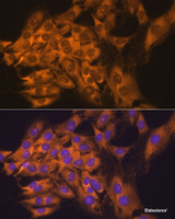 Immunofluorescence analysis of C6 cells using RPL17 Polyclonal Antibody at dilution of 1:100. Blue: DAPI for nuclear staining.