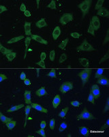 Immunofluorescence analysis of L-929 cells using EIF3D Polyclonal Antibody at dilution of 1:100. Blue: DAPI for nuclear staining.