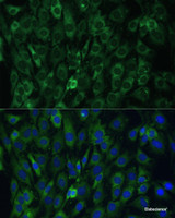 Immunofluorescence analysis of C6 cells using EIF3D Polyclonal Antibody at dilution of 1:100. Blue: DAPI for nuclear staining.