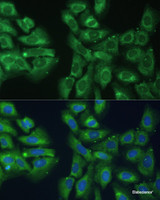 Immunofluorescence analysis of U-2 OS cells using EIF3D Polyclonal Antibody at dilution of 1:100. Blue: DAPI for nuclear staining.