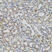 Immunohistochemistry of paraffin-embedded Rat kidney using TRMT2A Polyclonal Antibody at dilution of 1:100 (40x lens) .