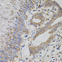 Immunohistochemistry of paraffin-embedded Human esophagus using TRMT2A Polyclonal Antibody at dilution of 1:100 (40x lens) .