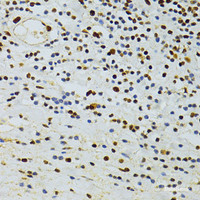 Immunohistochemistry of paraffin-embedded Human vermiform appendix using ALYREF Polyclonal Antibody at dilution of 1:100 (40x lens) .