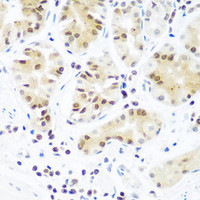 Immunohistochemistry of paraffin-embedded Human stomach using Argonaute-2 Polyclonal Antibody at dilution of 1:100 (40x lens) .
