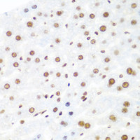Immunohistochemistry of paraffin-embedded Mouse liver using Argonaute-2 Polyclonal Antibody at dilution of 1:100 (40x lens) .
