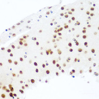 Immunohistochemistry of paraffin-embedded Mouse brain using Argonaute-2 Polyclonal Antibody at dilution of 1:100 (40x lens) .