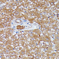 Immunohistochemistry of paraffin-embedded Rat liver using HDLBP Polyclonal Antibody at dilution of 1:100 (40x lens) .