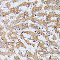 Immunohistochemistry of paraffin-embedded Human liver using HDLBP Polyclonal Antibody at dilution of 1:100 (40x lens) .