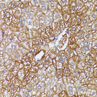 Immunohistochemistry of paraffin-embedded Mouse liver using HDLBP Polyclonal Antibody at dilution of 1:100 (40x lens) .