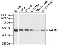 Western blot analysis of extracts of various cell lines using Polyclonal AntibodyPN1 Polyclonal Antibody at dilution of 1:1000.