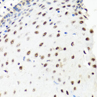 Immunohistochemistry of paraffin-embedded Human esophagus using PRPF8 Polyclonal Antibody at dilution of 1:100 (40x lens) .