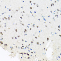 Immunohistochemistry of paraffin-embedded Rat brain using PRPF8 Polyclonal Antibody at dilution of 1:100 (40x lens) .