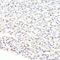 Immunohistochemistry of paraffin-embedded Mouse stomach using PRPF8 Polyclonal Antibody at dilution of 1:100 (40x lens) .