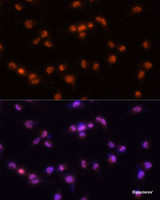 Immunofluorescence analysis of U-251MG cells using PRPF8 Polyclonal Antibody at dilution of 1:100 (20x lens) . Blue: DAPI for nuclear staining.