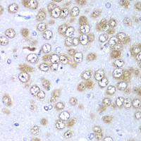 Immunohistochemistry of paraffin-embedded Rat brain using RPS10 Polyclonal Antibody at dilution of 1:100 (40x lens) .
