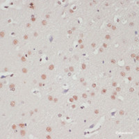 Immunohistochemistry of paraffin-embedded Rat brain using SNRNP70 Polyclonal Antibody at dilution of 1:100 (40x lens) .