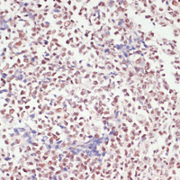 Immunohistochemistry of paraffin-embedded Human appendix using SNRNP70 Polyclonal Antibody at dilution of 1:100 (40x lens) .