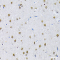 Immunohistochemistry of paraffin-embedded Rat brain using SRSF3 Polyclonal Antibody at dilution of 1:100 (40x lens) .
