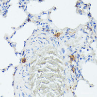 Immunohistochemistry of paraffin-embedded Rat lung using TIAL1 Polyclonal Antibody at dilution of 1:100 (40x lens) .