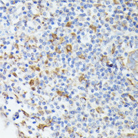 Immunohistochemistry of paraffin-embedded Human appendix using TIAL1 Polyclonal Antibody at dilution of 1:100 (40x lens) .