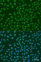 Immunofluorescence analysis of U2OS cells using HuR / ELAVL1 Polyclonal Antibody at dilution of 1:100. Blue: DAPI for nuclear staining.