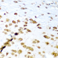 Immunohistochemistry of paraffin-embedded Mouse brain using ELAVL3 Polyclonal Antibody at dilution of 1:200 (40x lens) .