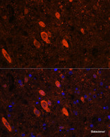 Immunofluorescence analysis of Rat brain using ELAVL3 Polyclonal Antibody at dilution of 1:100 (40x lens) . Blue: DAPI for nuclear staining.