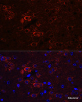 Immunofluorescence analysis of Mouse brain using ELAVL3 Polyclonal Antibody at dilution of 1:100 (40x lens) . Blue: DAPI for nuclear staining.