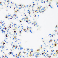 Immunohistochemistry of paraffin-embedded Rat lung using FMR1 Polyclonal Antibody at dilution of 1:100 (40x lens) .