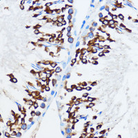 Immunohistochemistry of paraffin-embedded Rat testis using IGF2BP3 Polyclonal Antibody at dilution of 1:100 (40x lens) .