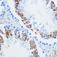 Immunohistochemistry of paraffin-embedded Mouse testis using IGF2BP3 Polyclonal Antibody at dilution of 1:100 (40x lens) .