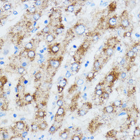 Immunohistochemistry of paraffin-embedded Human liver using IGF2BP3 Polyclonal Antibody at dilution of 1:100 (40x lens) .