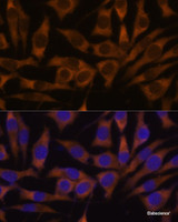 Immunofluorescence analysis of L929 cells using IGF2BP3 Polyclonal Antibody at dilution of 1:100. Blue: DAPI for nuclear staining.