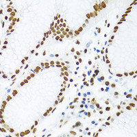 Immunohistochemistry of paraffin-embedded Human stomach using KHDRBS1 Polyclonal Antibody at dilution of 1:100 (40x lens) .