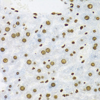 Immunohistochemistry of paraffin-embedded Mouse liver using KHDRBS1 Polyclonal Antibody at dilution of 1:100 (40x lens) .