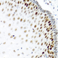 Immunohistochemistry of paraffin-embedded Human esophagus using KHDRBS2 Polyclonal Antibody at dilution of 1:100 (40x lens) .