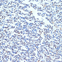 Immunohistochemistry of paraffin-embedded Human tonsil using PTBP1 Polyclonal Antibody at dilution of 1:100 (40x lens) .