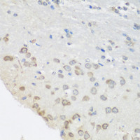 Immunohistochemistry of paraffin-embedded Mouse brain using PUM1 Polyclonal Antibody at dilution of 1:100 (40x lens) .