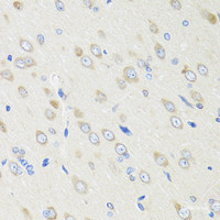 Immunohistochemistry of paraffin-embedded Rat brain using CRABP2 Polyclonal Antibody at dilution of 1:100 (40x lens) .