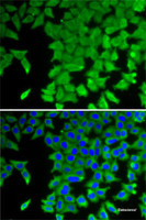 Immunofluorescence analysis of U2OS cells using CRABP2 Polyclonal Antibody
