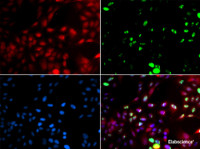 Immunofluorescence analysis of GFP-RNF168 transgenic U2OS cells using POLK Polyclonal Antibody