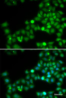 Immunofluorescence analysis of U2OS cells using POLK Polyclonal Antibody