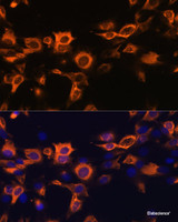 Immunofluorescence analysis of C6 cells using CSF2 Polyclonal Antibody at dilution of 1:100. Blue: DAPI for nuclear staining.