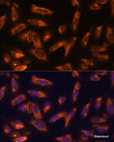 Immunofluorescence analysis of U-2 OS cells using CSF2 Polyclonal Antibody at dilution of 1:100. Blue: DAPI for nuclear staining.